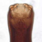 Adult Female Ancylostoma sp