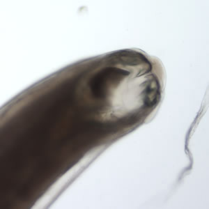 Adult Female Ancylostoma sp